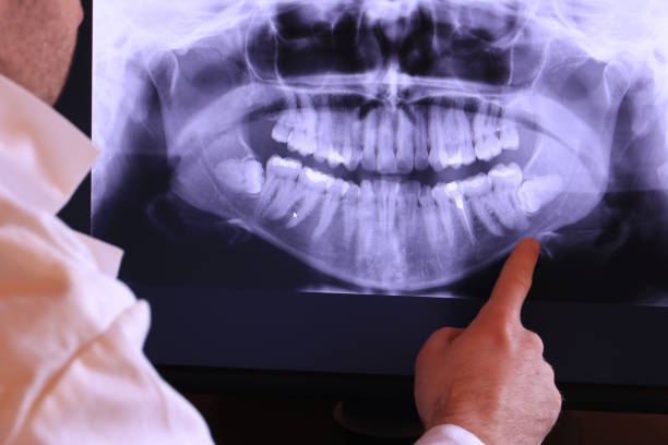 Best Emergency Dental Care for Abscessed Tooth in Morgantown, WV