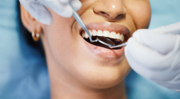Best Emergency Dental Extractions in Morgantown, WV